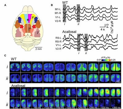 Large Scale Cortical Functional Networks Associated with Slow-Wave and Spindle-Burst-Related Spontaneous Activity